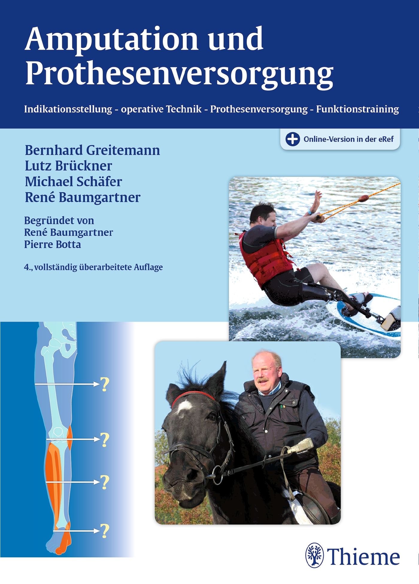 cover_Amputation_und_Prothesenversorgung